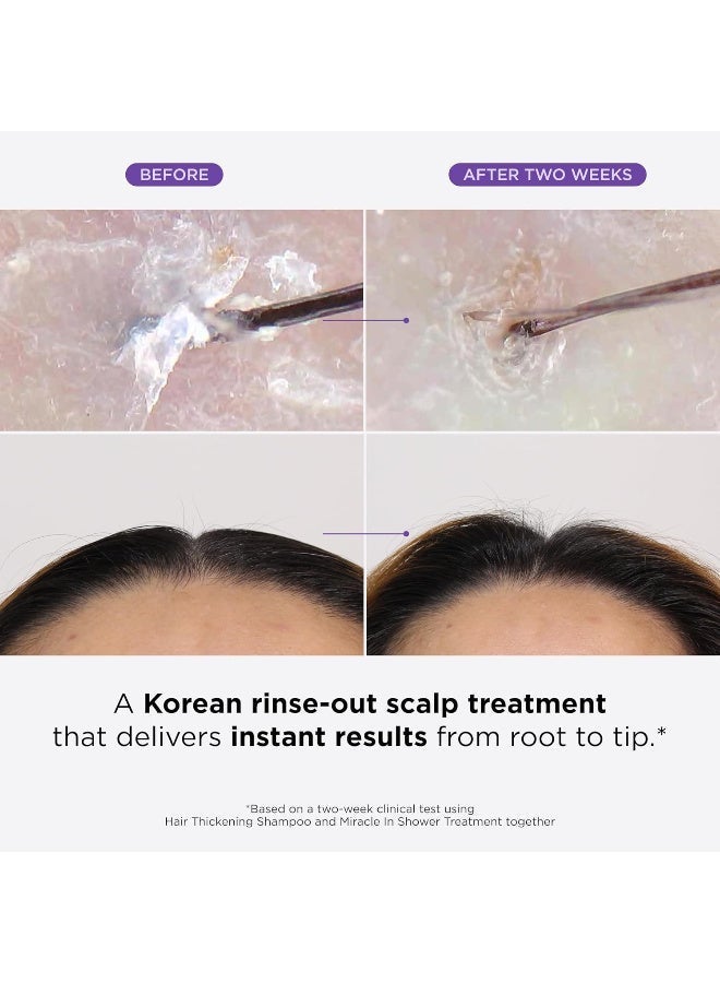 دكتور جروت معجزة في دش - علاج مرطب لفقدان الشعر ، غسل كوري للعناية بالشعر ، زيت الرومر لشعر ناعم وصحي في 5 ثوان ، محلول تنشيط جلد الشعر ، 8.5 أوقية فلورية - Image 2